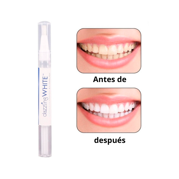 Dientes blancos en minutos: ¡el bolígrafo blanqueador que estabas esperando!
