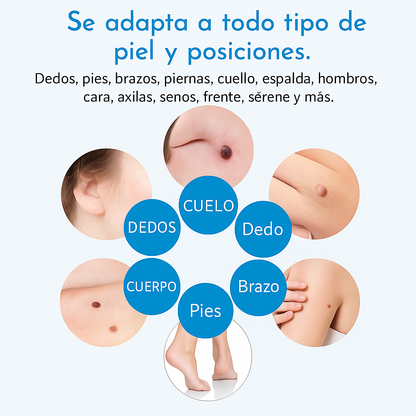 DermoClear™ – Elimina verrugas sin dolor, en casa y en solo 14 días