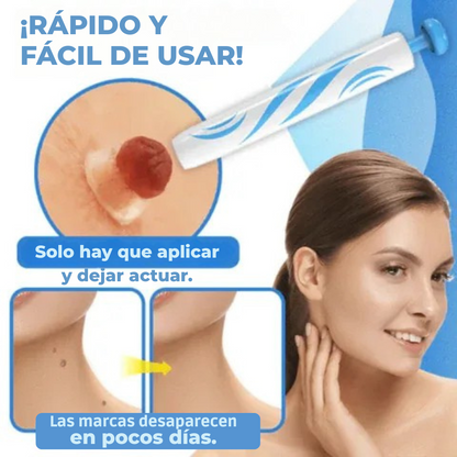DermoClear™ – Elimina verrugas sin dolor, en casa y en solo 14 días